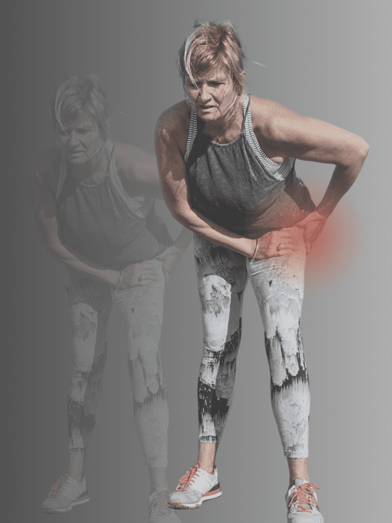 Hip Physiotherapy